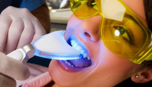 Безопасная установка страз на зубы
