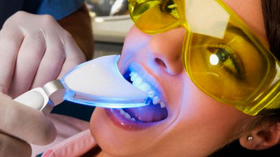 Безопасная установка страз на зубы